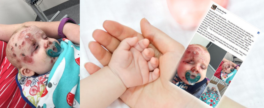 Mądry rodzic po szkodzie – przeczytaj,  zanim odmówisz dziecku szczepień!